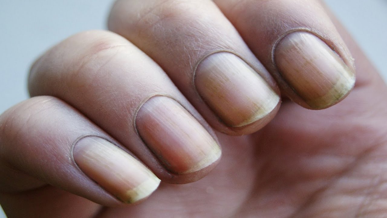 7 Maddede Kadınlar Neden Oje Sürer