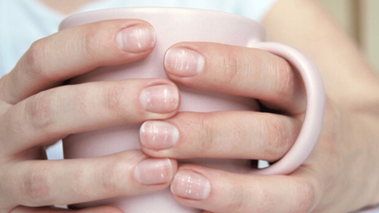 Neden Oje Sürer Tırnaklarda Oluşan Beyaz Lekeleri Kapamak